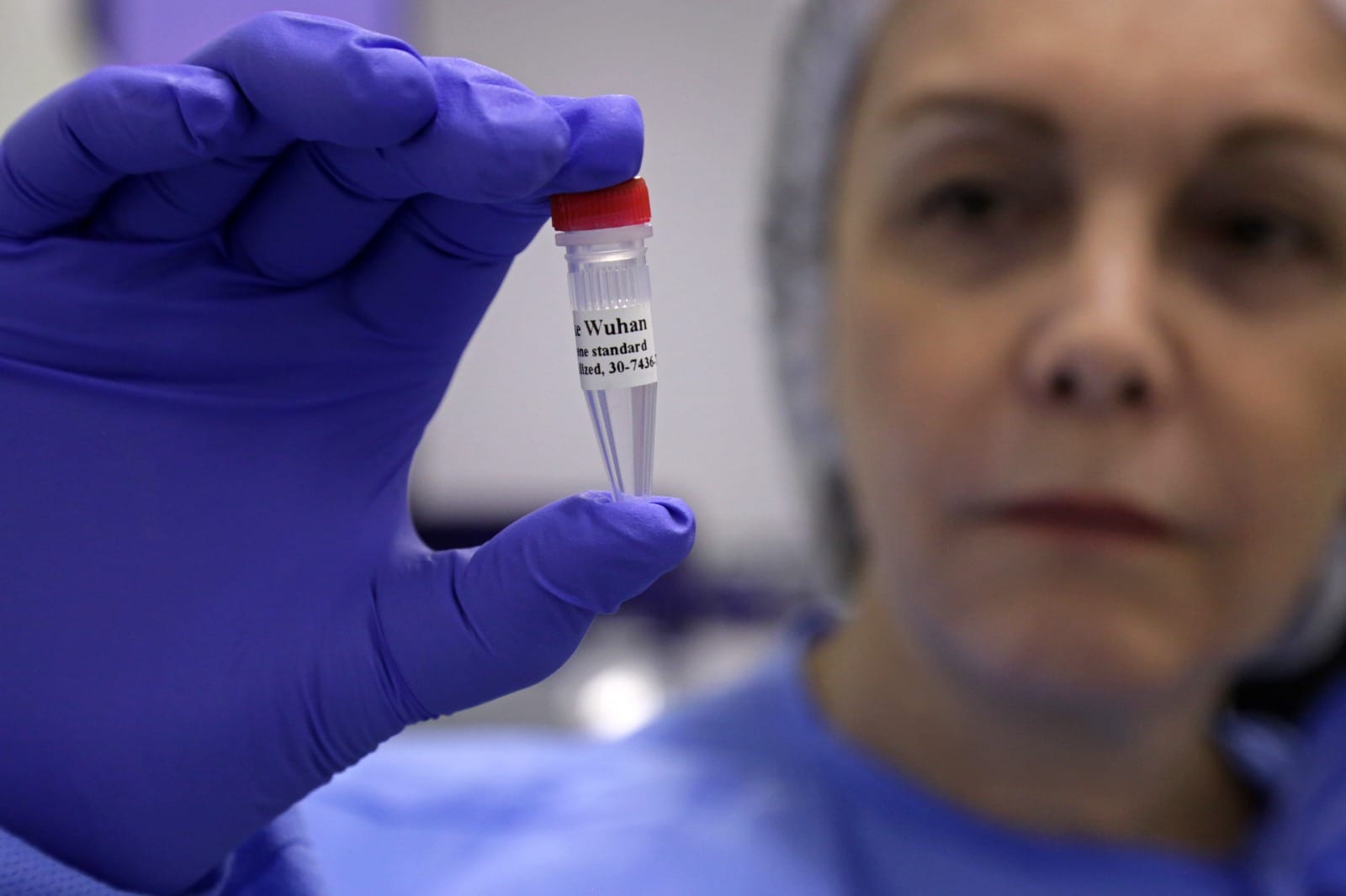 Fiocruz e OPAS iniciam capacitação de laboratórios públicos para diagnóstico da doença